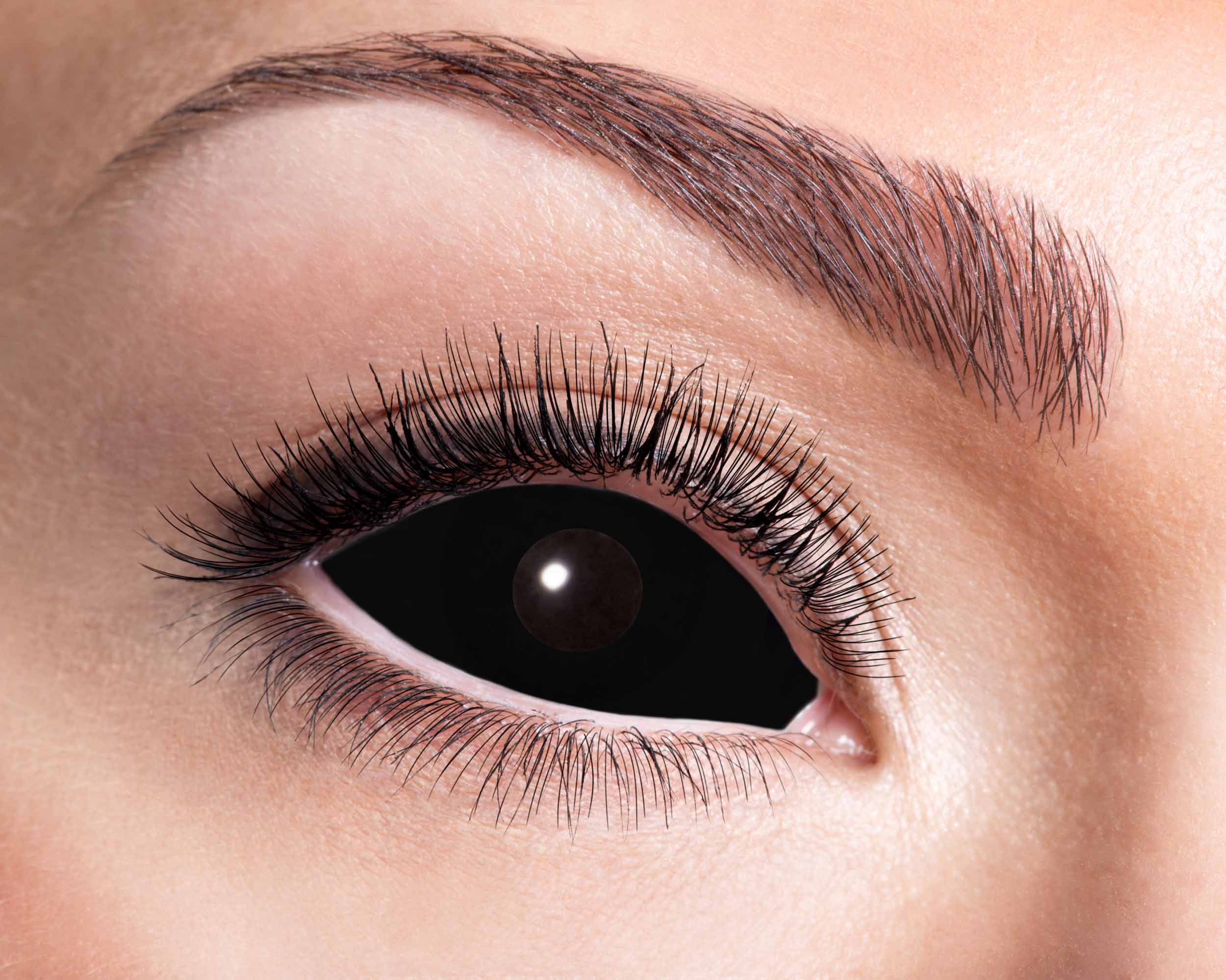 Sclera