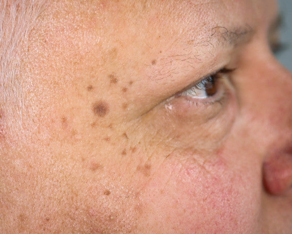 Age Marks - Tattoo Transfer