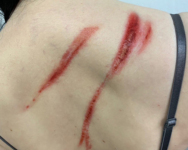 Ruoskan iskut 1 - traumatatuoinnit