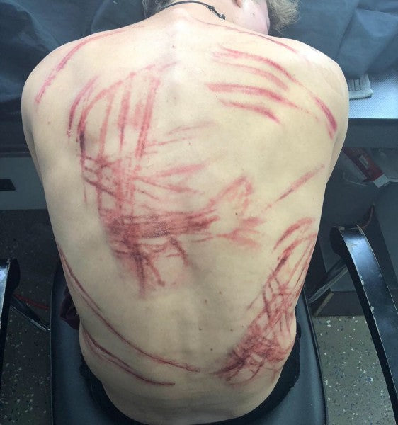 Ruoskan iskut 2 - traumatatuoinnit