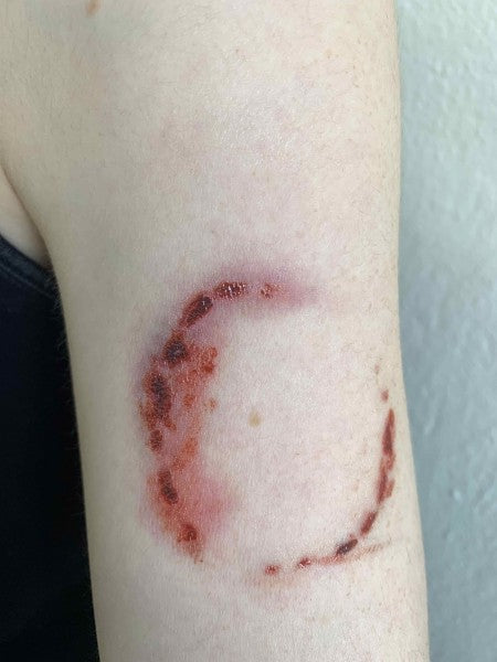 Scars and Sutures A - Tattoo Transfer    
