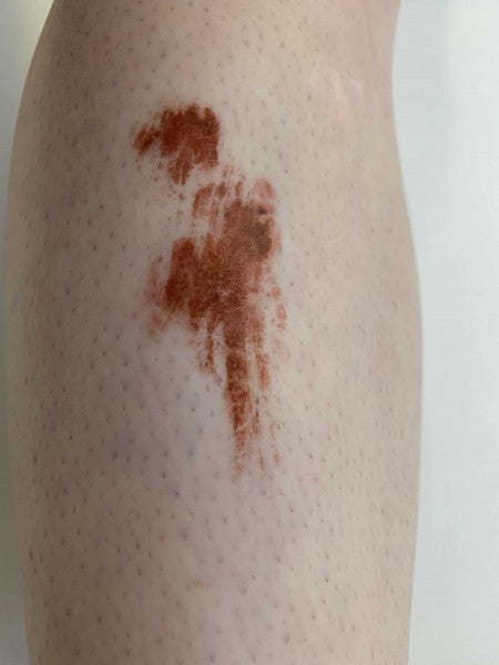 Skin Scrapes 2 - Tattoo Transfer