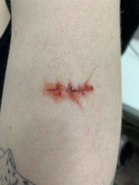 Scars and Sutures A - Tattoo Transfer    